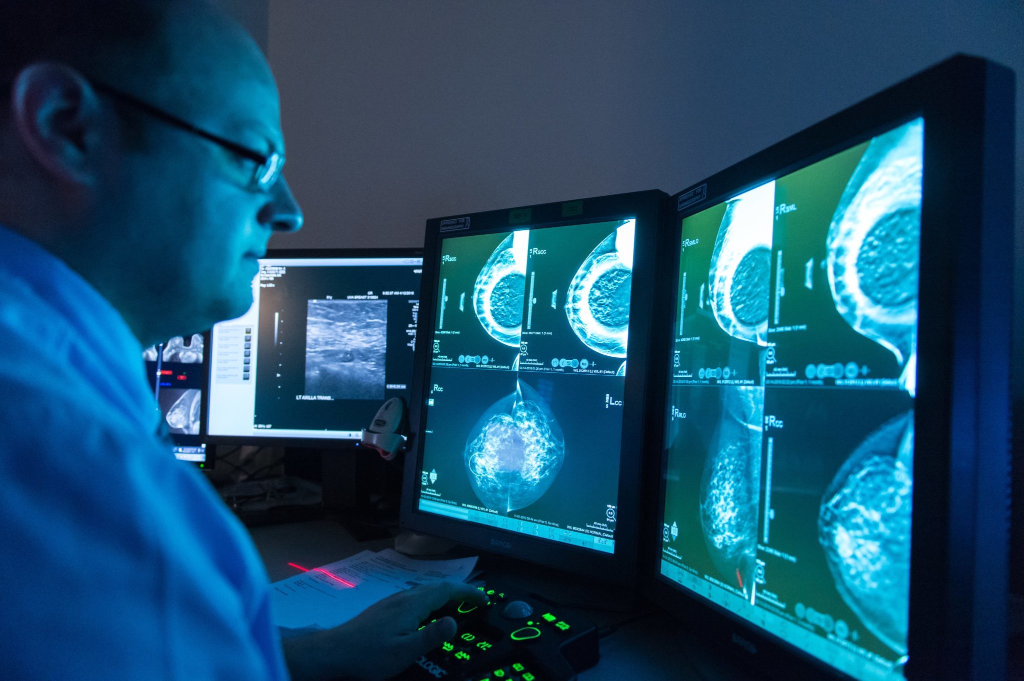 An Image of a Breast Radiologist reading a mammogram. 