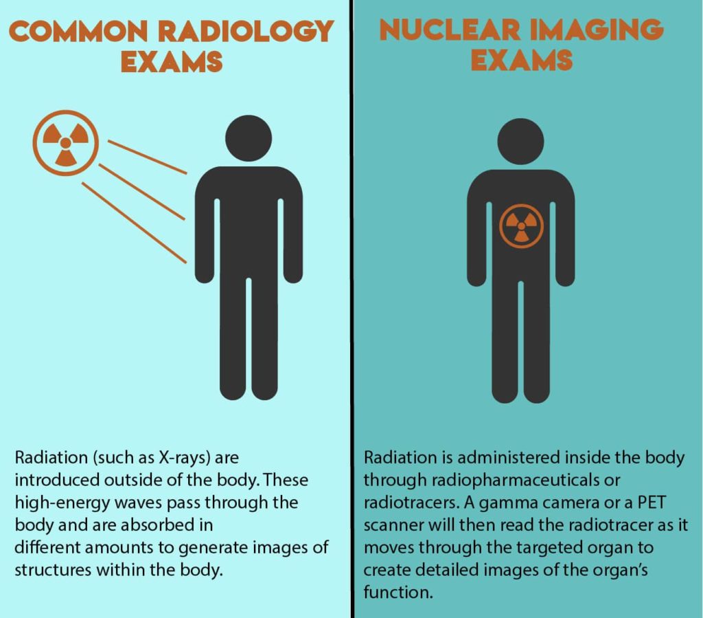 Infographic that shows the difference between common radiology exams (radiation introduced outside the body) and nuclear imaging (radiation administered inside the body.) 