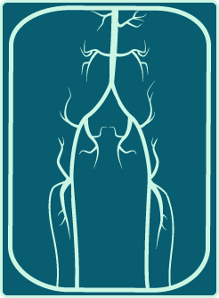 A stylized graphic of an angiogram