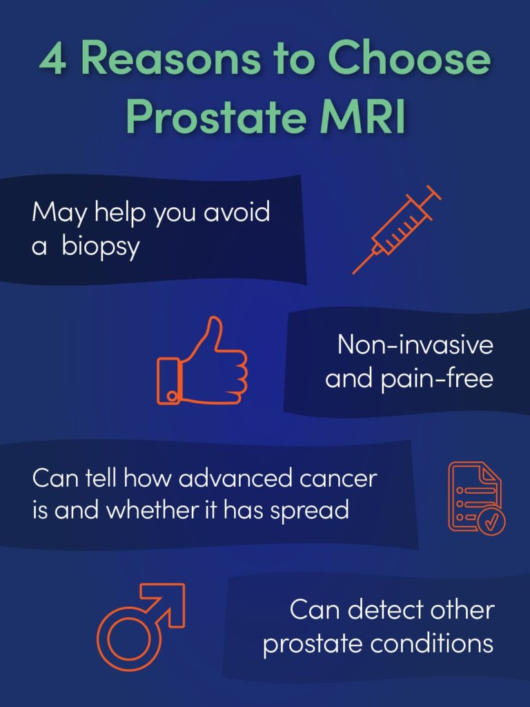 4 Reasons to Choose Prostate MRI