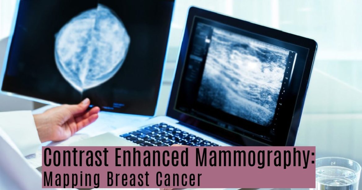 Contrast Enhanced Mammography: Mapping Breast Cancer I UVA Radiology ...