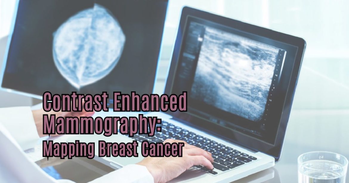 Header Image for Article "Mapping Breast Cancer: Contrast Enhanced Mammography"