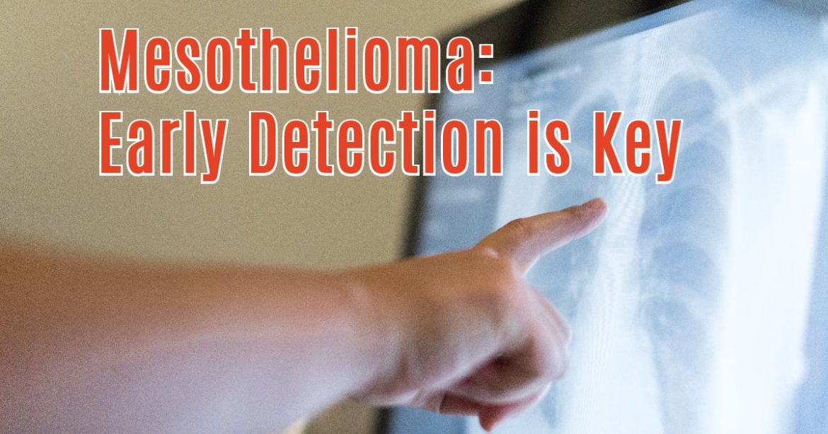 Article Header reading "Mesothelioma: Early Detection is Key"