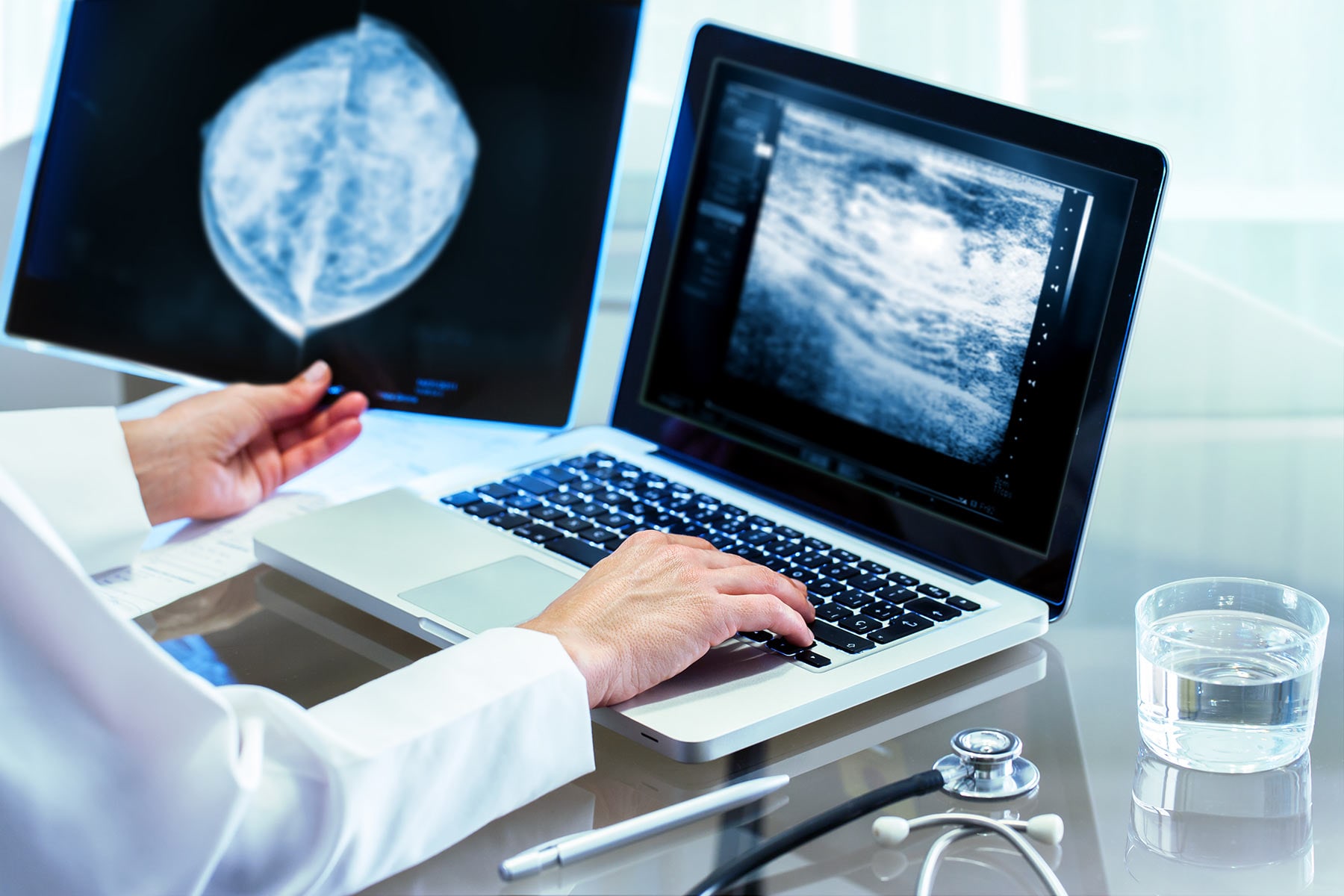 Contrast-Enhanced Spectral Mammography: What and Why? - UVA