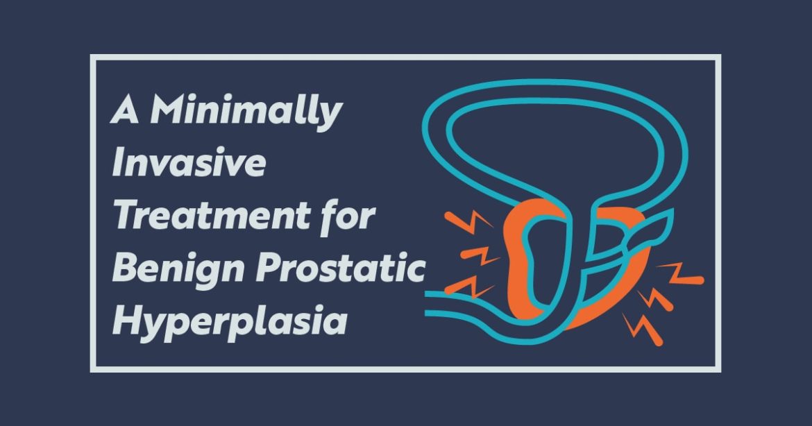 A Minimally Invasive Treatment for Benign Prostate Hyperplasia