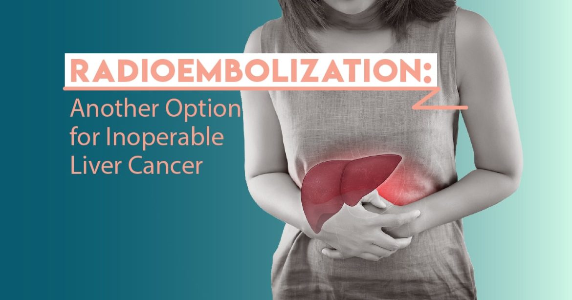 Header image for article "Radioembolization: Another Option for Inoperable Liver Cancer"