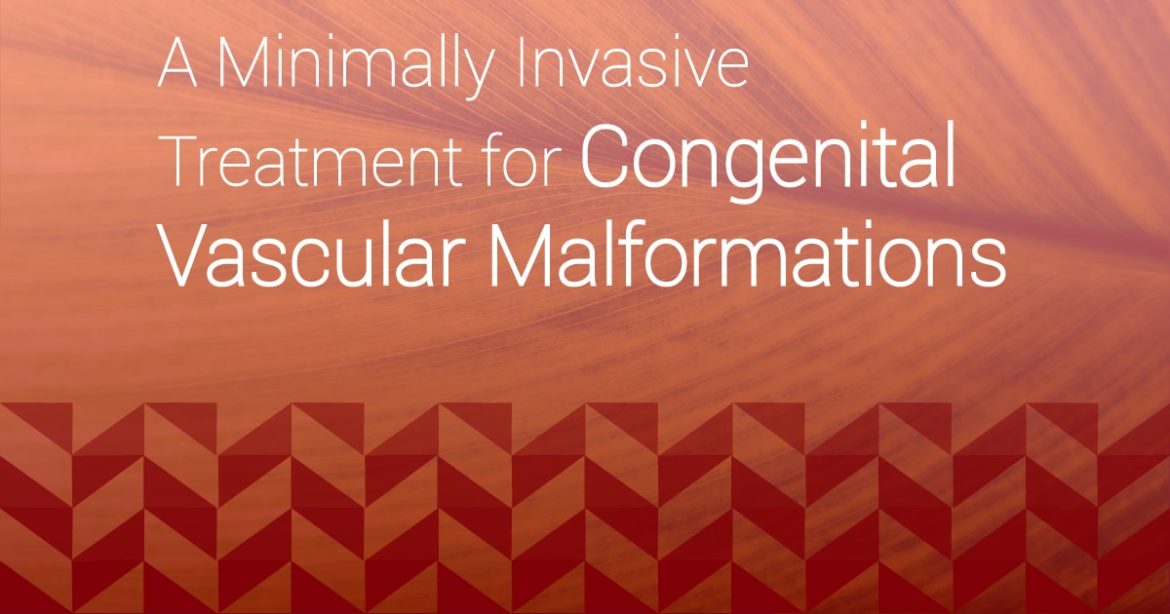 Header Image reading "A Minimally Invasive Treatment for Congenital Vascular Malformations