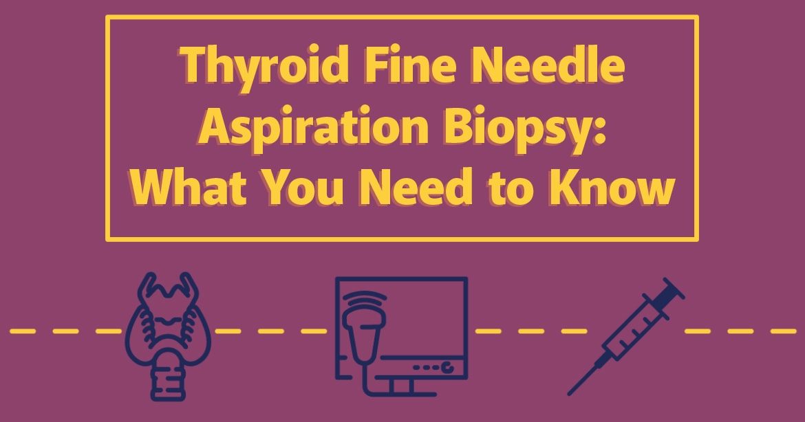 Thyroid Fine Needle Aspiration Biopsy: What You Need to Know