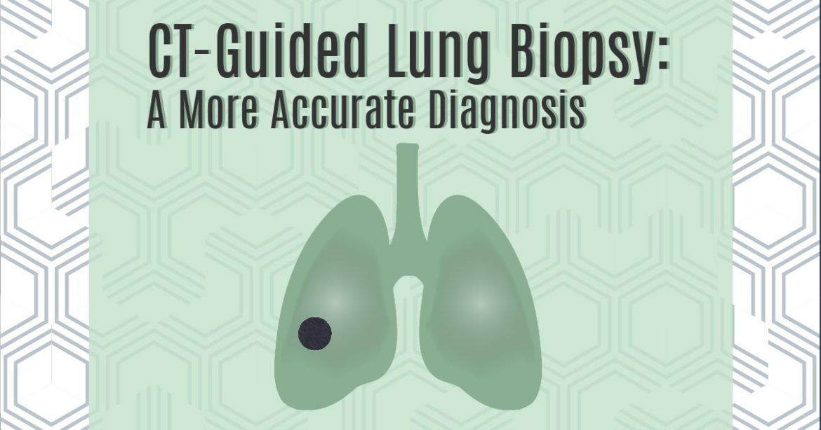 Header Image for article reading"CT-Guided Lung Biopsy: A More Accurate Diagnosis"
