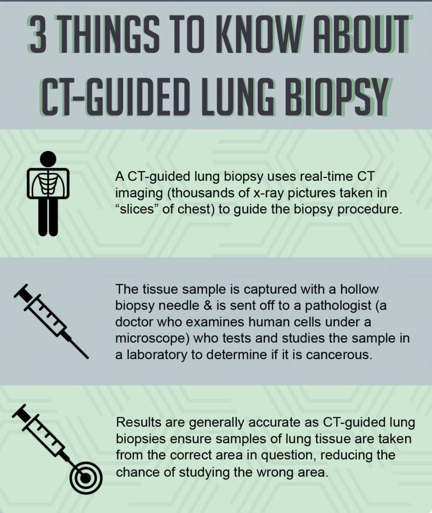 An infographic with 3 Things to know about CT-Guided Lung Biopsy. 1) A CT-guided lung biopsy uses real-time CT imaging (thousands of x-ray pictures taken in “slices” of chest) to guide the biopsy procedure. 2.) The tissue sample is captured with a hollow biopsy needle & is sent off to a pathologist (a doctor who examines human cells under a microscope) who tests and studies the sample in a laboratory to determine if it is cancerous. 3.) Results are generally accurate as CT-guided lung biopsies ensure samples of lung tissue are taken from the correct area in question, reducing the chance of studying the wrong area.