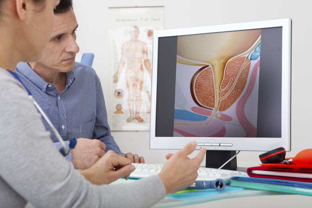 Doctor showing a patient an image of a prostate