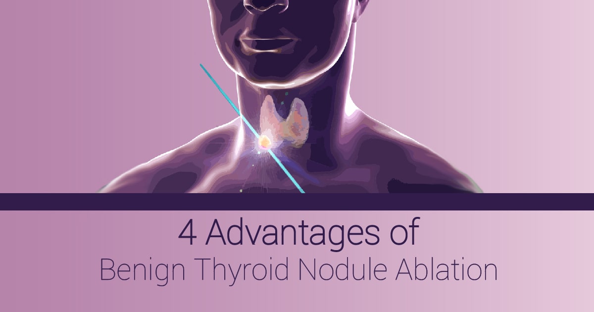 Benign Thyroid Nodule Ablation  UVA Radiology & Medical Imaging