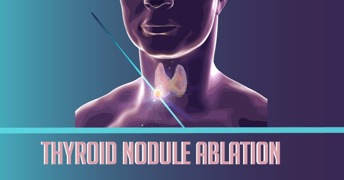 uva-radiology-medical-imaging-benign-thyroid-nodule-ablation