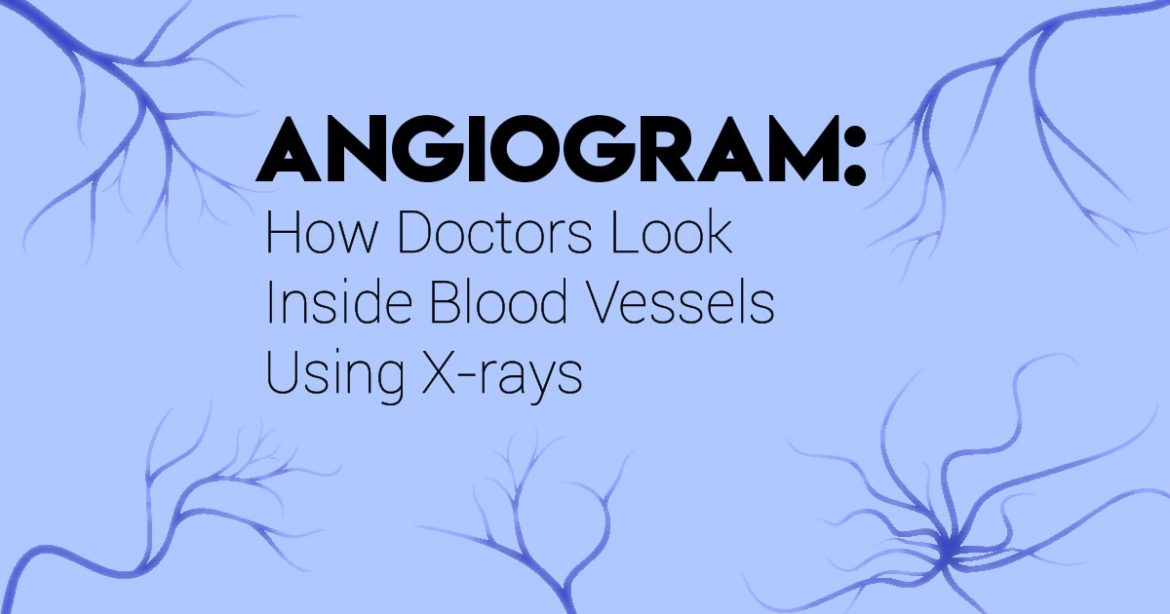 Article Header reading "Angiogram: How Doctors Look Inside Blood Vessels Using X-rays"