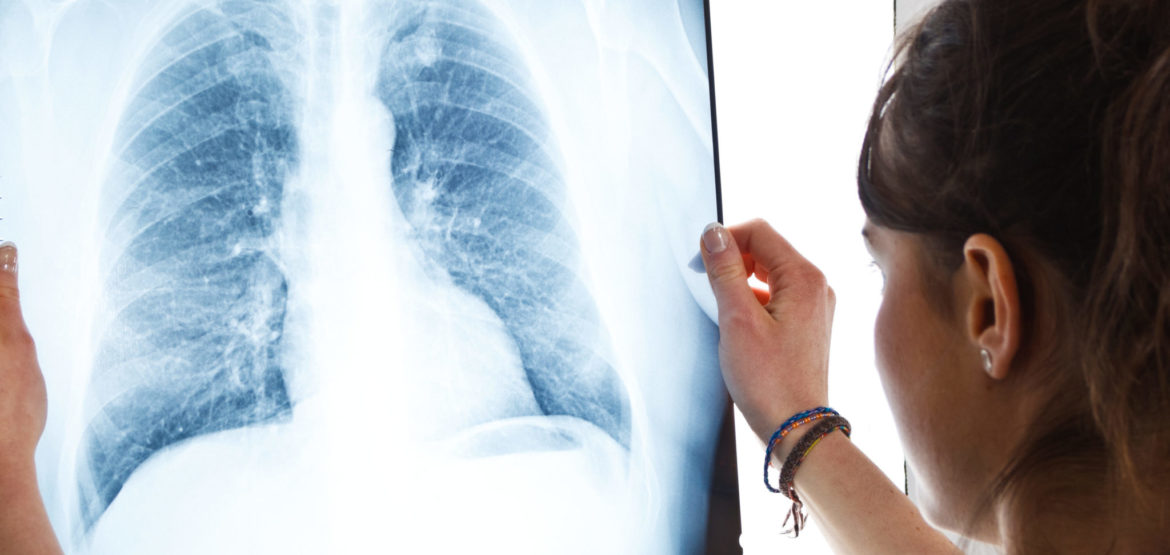 B Reader: Choosing a Lung Imaging Radiologist Can Make a Difference ...